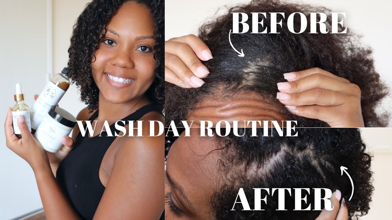 HOW TO GET RID OF SCALP PSORIASIS WASH DAY ROUTINE FT. LAVISH CURLS
