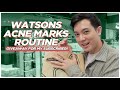 UNDER P2000 WATSONS SKINCARE for ACNE MARKS? Shopping for a SUBSCRIBER! (Filipino) | Jan Angelo