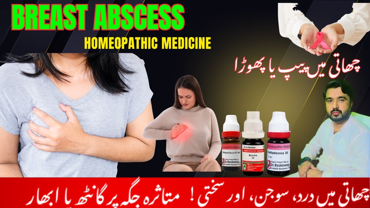 Breast abscess  Causes & Treatment!Signs & Symptoms of a Breast Abscess homeopathic medicine