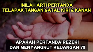 Inilah Pertanda Telapak Tangan Kiri & Kanan Gatal, Apakah Pertanda Rezeki ?Arti Telapak Tangan Gatal
