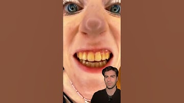 Fix These YELLOW Teeth