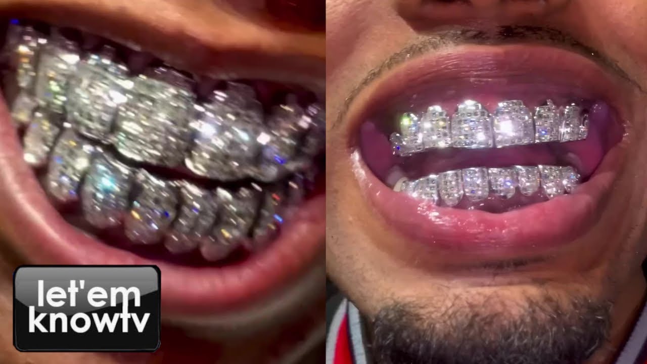 Jeweler Plug Geo Just Went All The Way On These Crazy Diamond Grillz