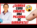 🔵 ¿CÓMO CURAR LA  PICADURA DE GARRAPATA DE PERRO EN HUMANOS? 🔵Síntomas y Tratamiento