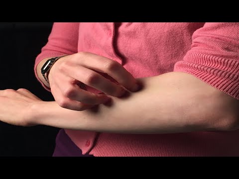 Why Scratching an Itch Feels So Good