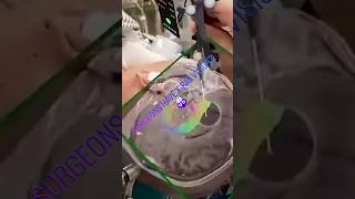 How AR is Giving Surgeons "X-Ray" Vision! 🤯 #shorts #tech