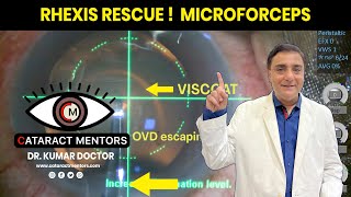 Rhexis Rescue ! Microforceps