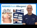 Patch testing for skin allergy in Boise with Ada West Dermatology