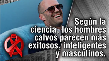 ¿Los hombres calvos son más dominantes?