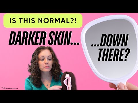 Is darker skin DOWN THERE *normal*?? Should you lighten it?? |  Dr. Jennifer Lincoln