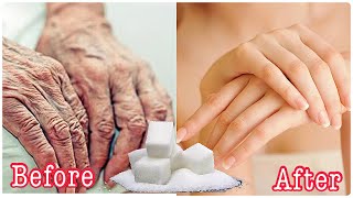 Sugar in 5 days remove wrinkles on hands and fingers completely get baby hands fast