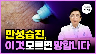 만성습진, 치료의 시작은 이것입니다.