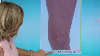 Crepe Erase Home & Away Intensive Body Treatment Set on QVC