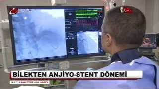 El Bileğinden Stent Ile Güvenli Ve Konforlu Kalp Tedavisi - Ktürk Ana Haber