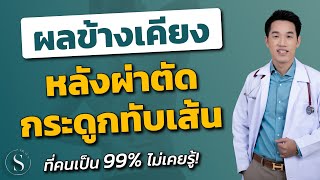 ผลข้างเคียง ผ่าตัด กระดูกทับเส้น ที่คนเป็น 99% ไม่เคยรู้ | หมอซัน หมอซันรีวิว หมอฝังเข็ม