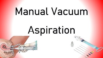 Manual Vacuum Aspiration (MVA)