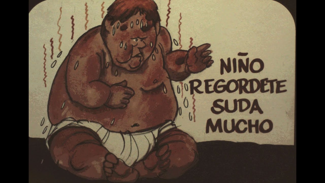 Homeopático E87   CALCAREA CARBONICA