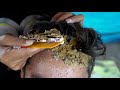 Itchy Dry Scalp Big Dandruff Scratching!! - Scratching Off Scalp Psoriasis #148