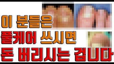 풀케어 쓰기 전에 꼭 보셔야 할 영상! 풀케어나 주블리아를 쓸 수 없는 손발톱무좀 알려드립니다.