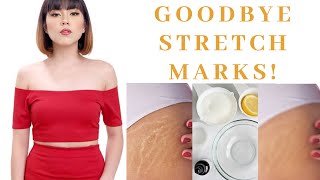 SAY GOODBYE TO STRETCHMARKS | EFFECTIVE WAYS screenshot 1