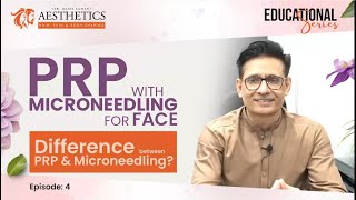 Difference between PRP and Micro needling in Urdu.