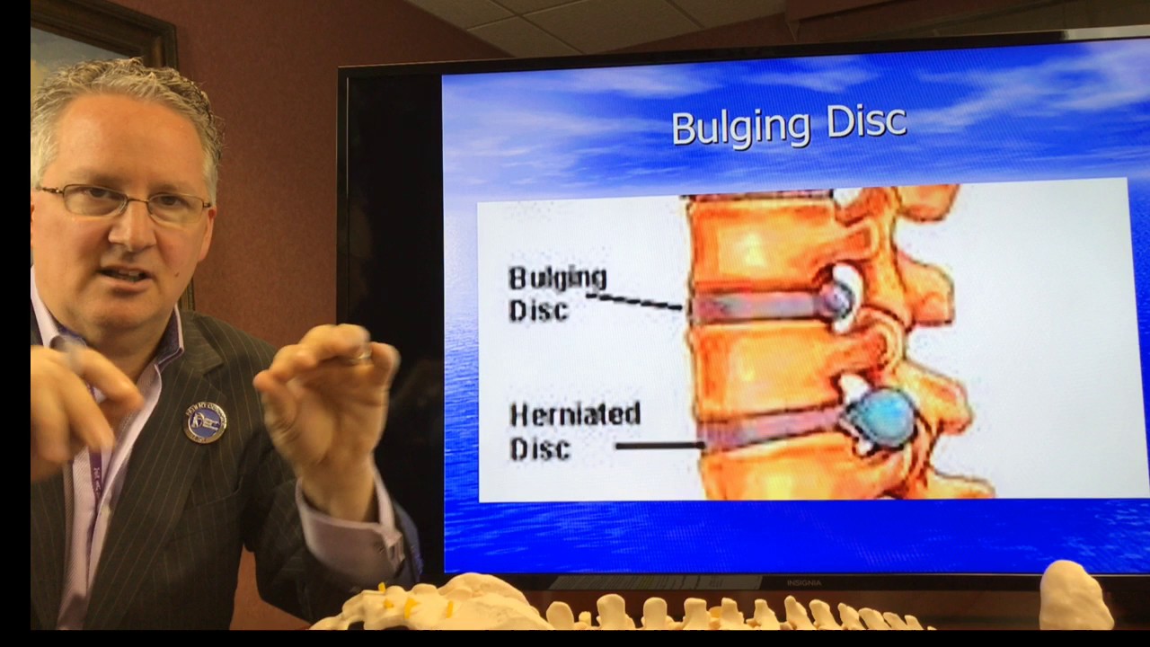 What Is The Key To Eliminating Your Back Pain? sciatica treatment medication