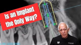 The Little Known Reason You Shouldnt Extract That Loose Tooth