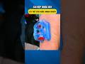 iTClamp - Công Nghệ Cầm Máu Trong 10 Giây