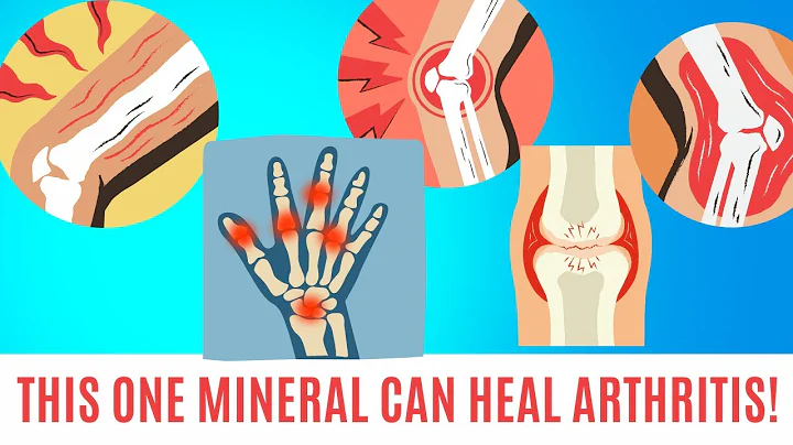This One Mineral Can Heal Arthritis! Not Magnesium, not Calcium