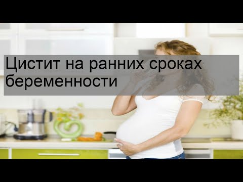 Цистит на ранних сроках беременности