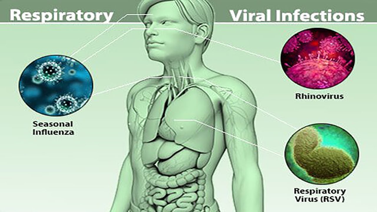 Understanding bacterial viruses. Viral infection. Bacterial infection vs virus infection like Symptoms. Respiratory virus