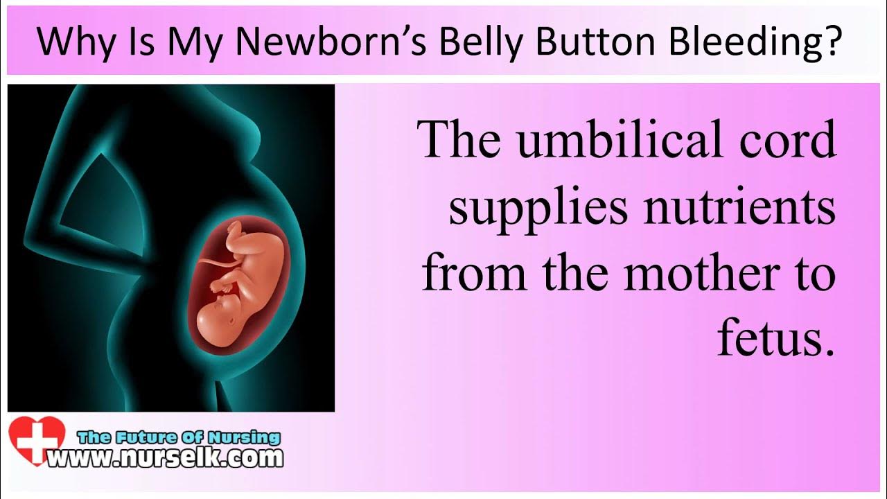 Why Is My Newborn’s Belly Button Bleeding YouTube