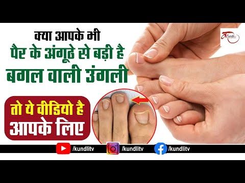 वीडियो: क्या पैर की उंगलियों में पैर के अंगूठे होते हैं?