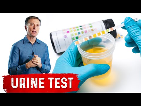 Urine Test Simplified