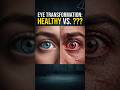 What Happens If Humans Stop Blinking? 👁😳 #facts #growth #inspiration #mindset #motivation #ai #eyes