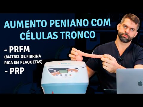 Vídeo: Penectomia Para Câncer Peniano: Recuperação, Procedimento E Muito Mais