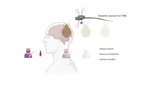 Dendritic calcium ion TMS prototype 2026