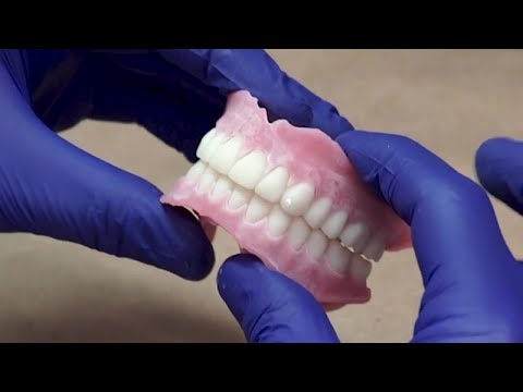 NextDent 5100 Dental 3D Printer is Having a Real Impact on Patient Lives