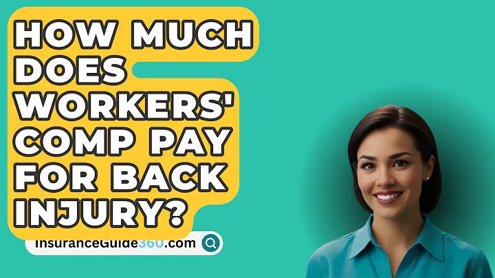 How Much Does Workers' Comp Pay For Back Injury? -  InsuranceGuide360.com
