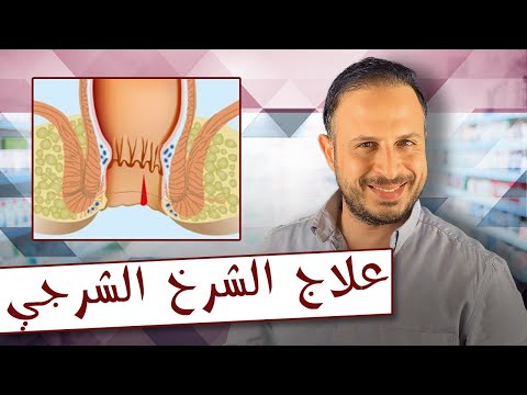 علاج الناسور الفرق بين الناسور والبواسير