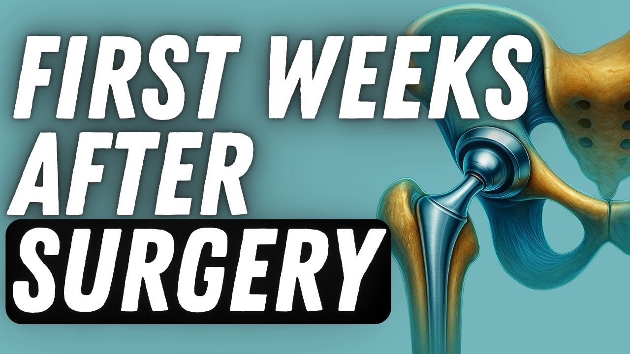 Hip Replacement Recovery: What to Expect After Surgery