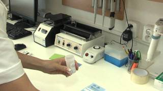 Bioptická laboratoř: Liquid Based Cytologie