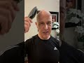 Simple Remedies For Balding & Hair Loss | Dr. Mandell