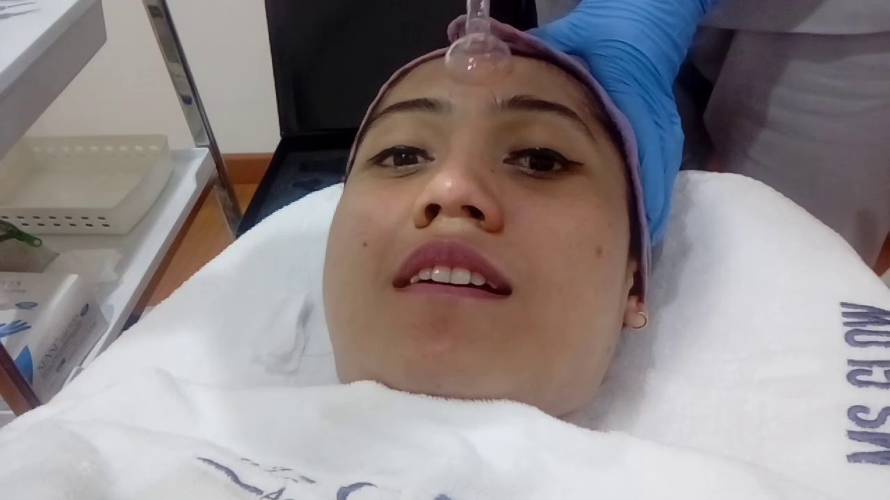 Review Treatment di MS Glow Aesthetic Clinic Bandung - YouTube