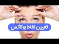 آموزش بوتاکس جلسه سوم تعیین نقاط بوتاکس