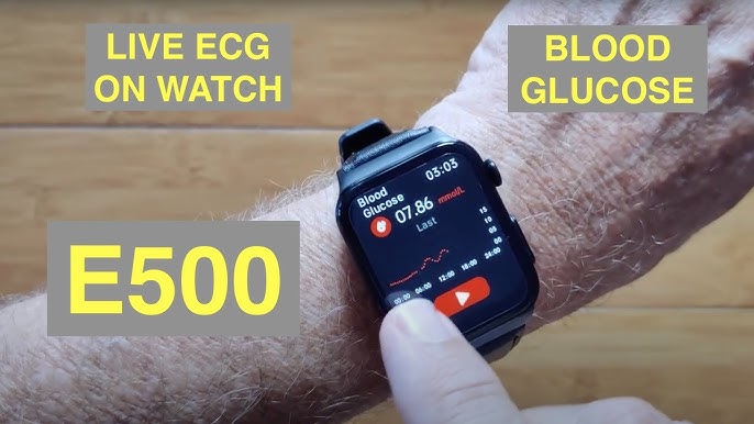 Reloj E-500 Monitorea Glucosa y Signos Vitales ¿Nivel Médico?, Mi
