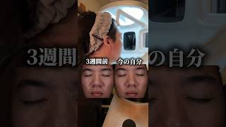 'えぐいほど肌が綺麗になった'ので紹介する。