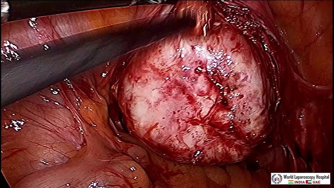 Men yotoqxonada porno qilishni xohlayman