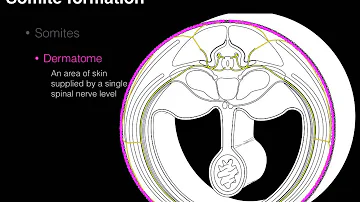What is a Somite in medicine?