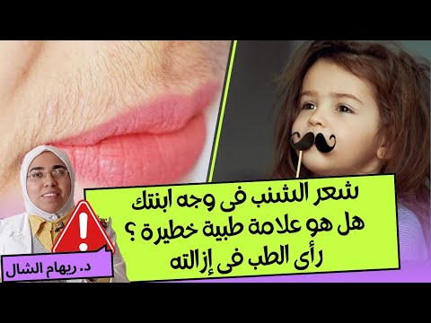 شعر الشنب فى وجه ابنتى كيف اتصرف و احميها د ريهام الشال