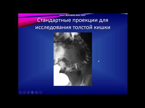 Лучевая диагностика ЖКТ